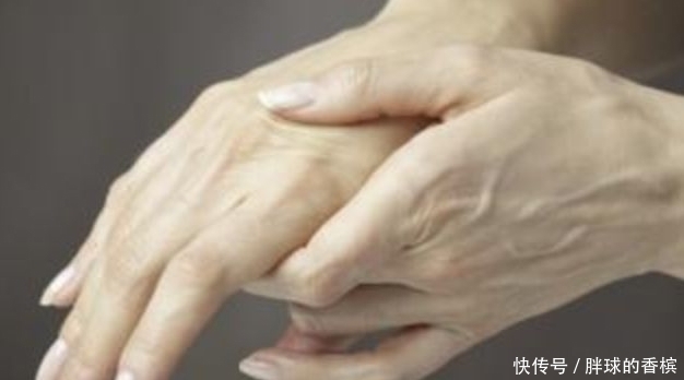 人可以说|血糖高不高先看手,若没有3个“表现”恭喜,你的血糖很稳定