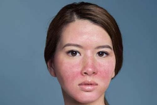 拯救敏感肌并不难！你平时注意这几点，就是在修复你的肌肤屏障！