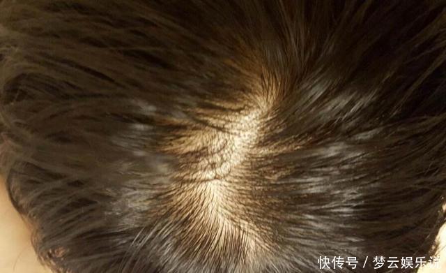 红豆|三伏天若你没有6个迹象，说明体内“湿气不重”，可喜可贺