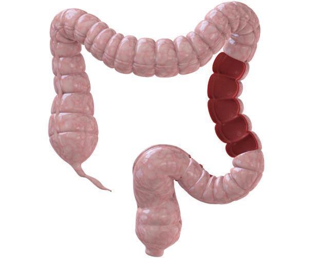 便秘|宿便堆积，会导致便秘教你一招刺激大肠蠕动，清肠道、排出宿便