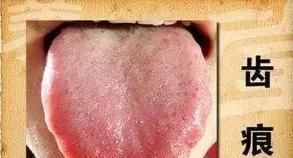 脾胃|十人九虚!老中医一个妙方,1味中药泡茶喝,轻松改善气虚体质