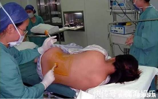 剖腹产|剖腹产的伤口,对女性身体会不会产生伤害,妇产科医生说出真相