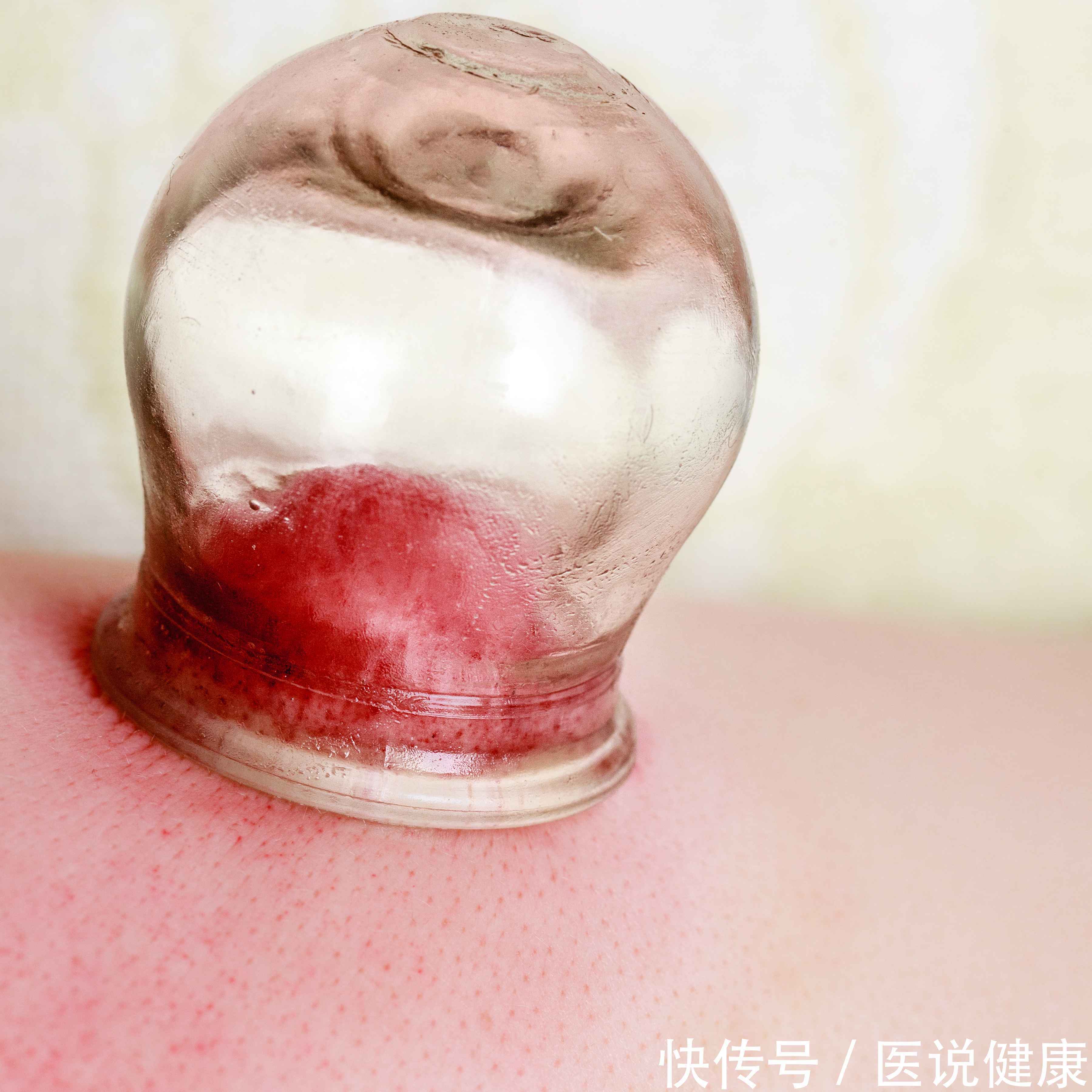 泡脚|小腹越来越大,或是湿气重导致的,做好5件事,或能去除体内湿气