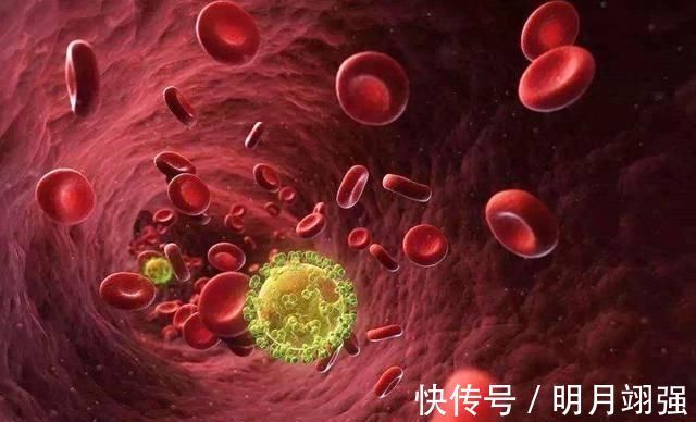 疾病|这几种遗传病患者,最好别要孩子,别拿个人的无知去坑孩子