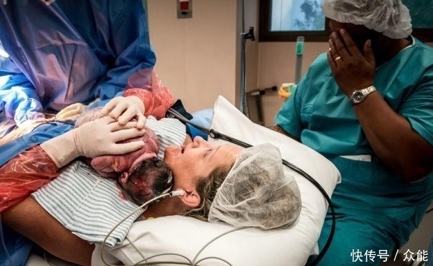 硬膜外麻醉|奇闻：女子觉得孩子出生第一个抱的人很重要，手术台上，自己接生