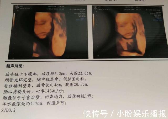 怀孕|孕期，总是担心胎儿发育其实做好3件事，畸形没那么容易发生