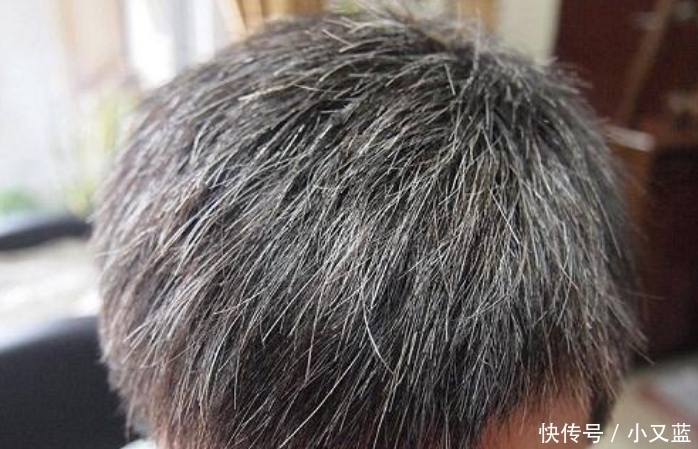 白发不要染,洗头水里放点“它”,坚持一个月,白发慢慢变黑发