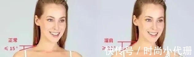 谣言|关于斜方肌的谣言，适可而止吧！