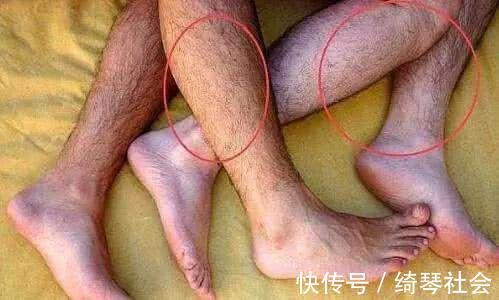 腿毛|腿毛旺盛和腿毛很少的男人，有什么不同专家一次性说清楚