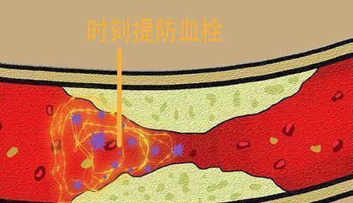 洋葱|此物是血栓的克星50岁后，每天吃一点，或能清理血管，排出血栓