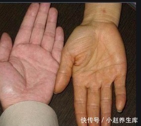 男孩|16岁男孩,查出肝癌,医生怒斥家长:啥东西都敢给孩子吃