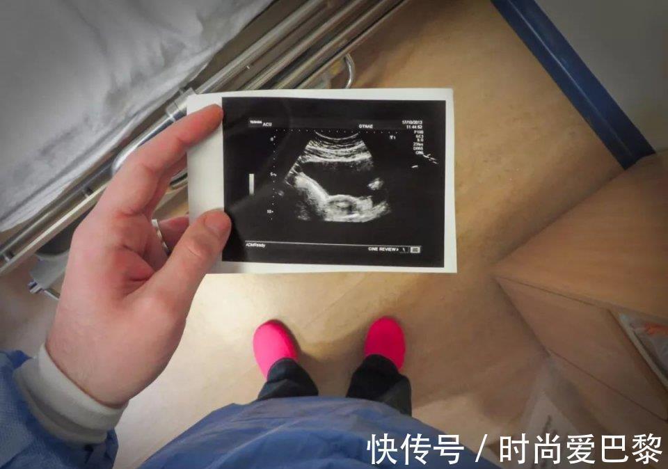 生化妊娠|怀孕头三个月为啥不能说?这里头学问可大了