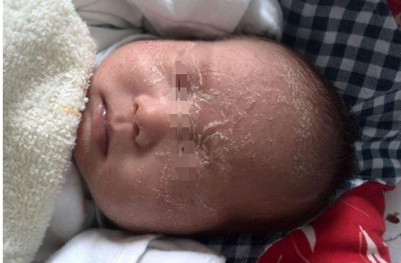 宝宝|宝宝突然身上掉皮,妈妈却不敢抱他,医院检查后,宝妈很尴尬了