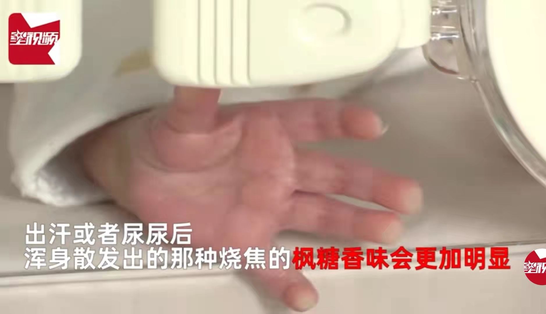 香妃同款？新生儿得罕见病全身散发一股甜香，洗都洗不掉！