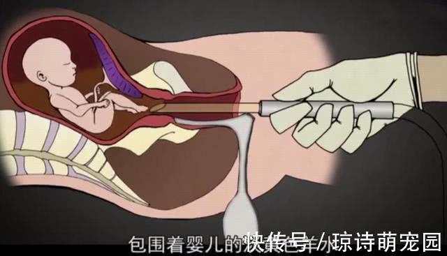 胎儿|孕妇被迫引产,腹中胎儿有感觉吗?看完这些画面,后悔得掩面痛哭