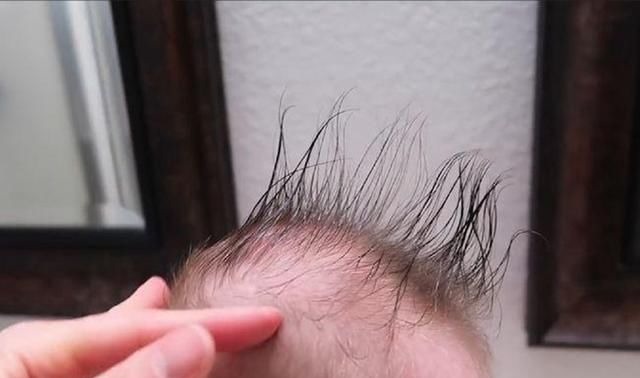 营养物质|新生儿头发稀少只因遗传?做好这5点宝宝头发浓又密,赶紧学起来