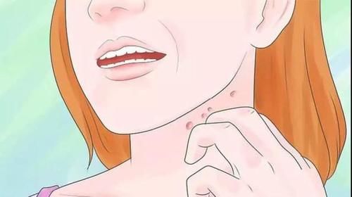 为什么“痘痘”在同一位置反复长？这个原因要知道