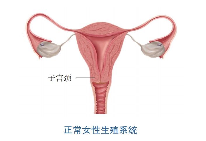 宫颈癌|女性不同年龄段应该多久做1次宫颈癌筛查？宫颈癌疫苗又该如何选择？