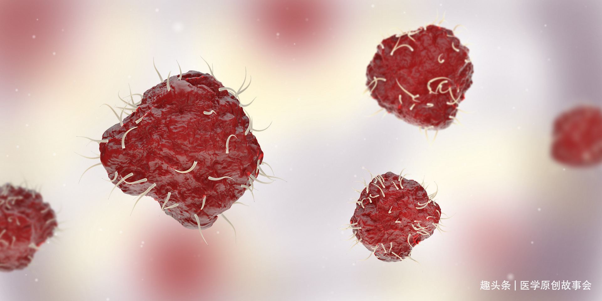 焦点访谈|央视主持人肖晓琳因直肠癌去世，大便若有六个特征，提示该体检了