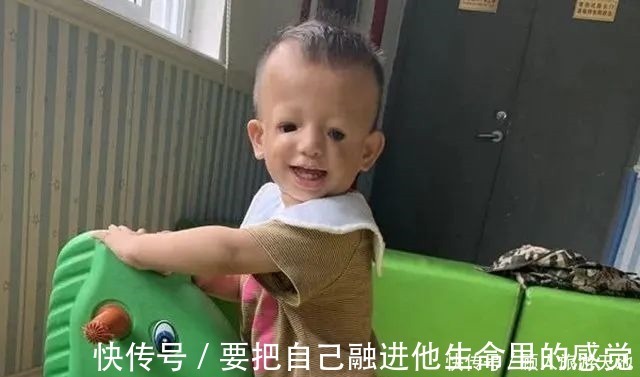 孩子|“鸟脸”妈妈执意生二胎,孩子不幸被遗传,一时的冲动毁孩子一生