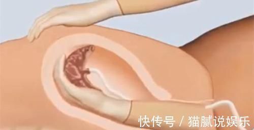 出血|产后2小时,产妇的身体会发生什么变化看完感慨妈妈不容易