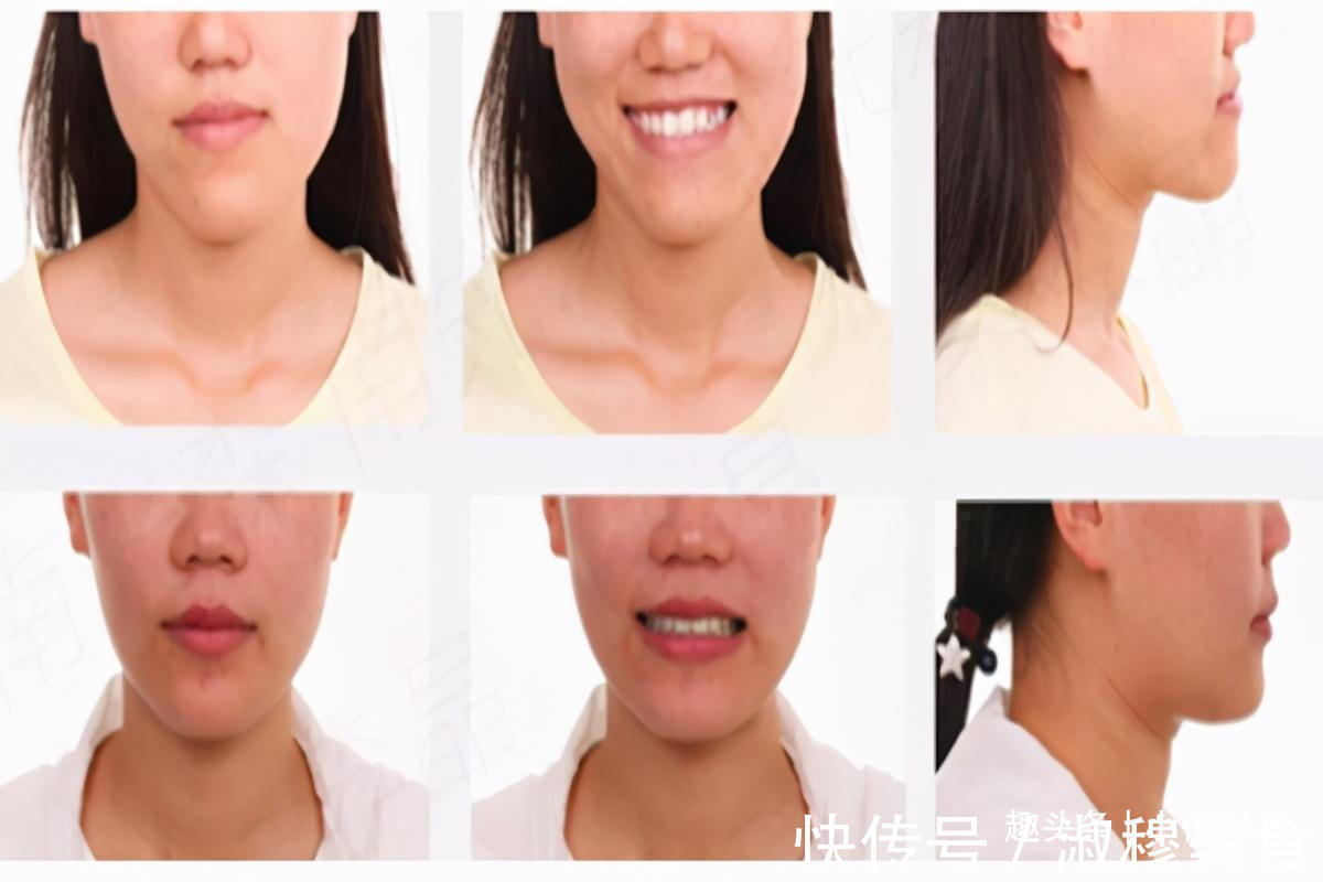 宝宝|带有“福相”的孩子,一般有4个特征,你家娃占了几个