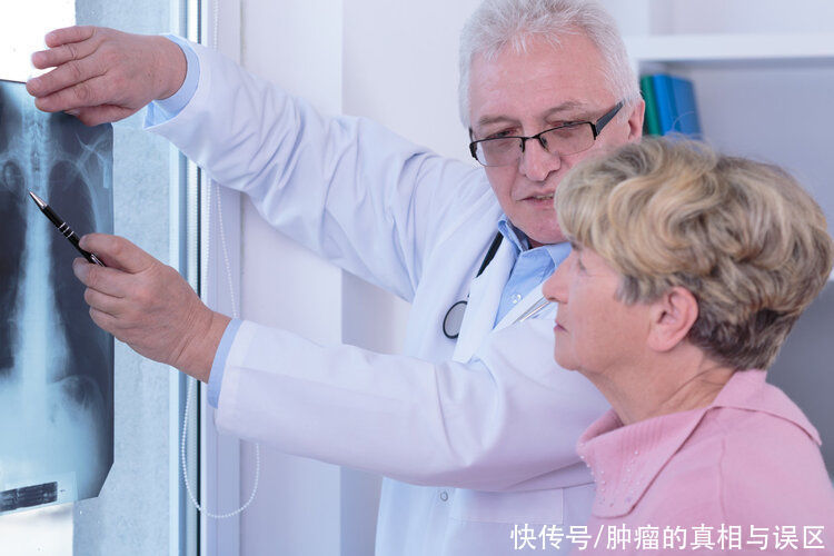 复发|癌症多久不复发才算治愈?4个检查全正常,恭喜你离治愈不远了