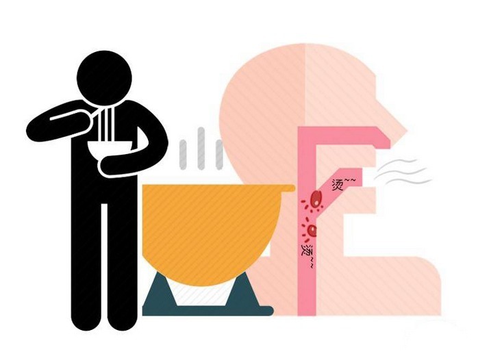 异样感|这种情况易和食管癌混淆!别大意,若伴随3种不适,有必要排查!