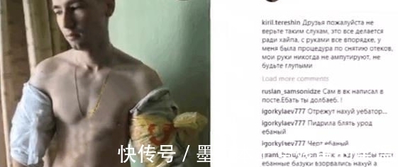 男子|男子在健身房健身时,因为用力过猛感觉不对,抬头观察,手臂爆啦