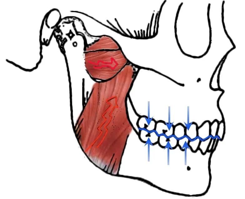 颞下颌关节|“咬牙”会帮助运动员拿“金牌”吗？