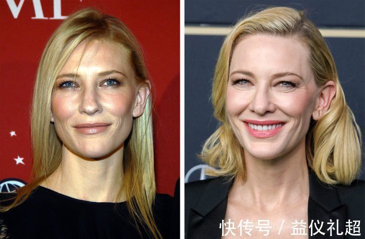 真实年龄|9个“直接戳破真实年龄”的衰老迹象,化妆也遮不住