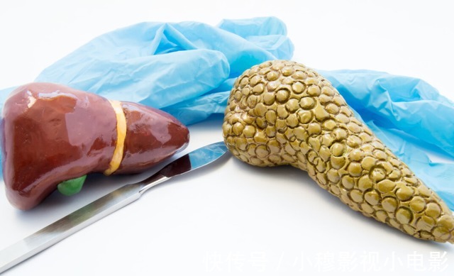 肝脏健康|医生建议:肝不好的人,尽量少吃3种水果,牢记2个方法或利于养肝