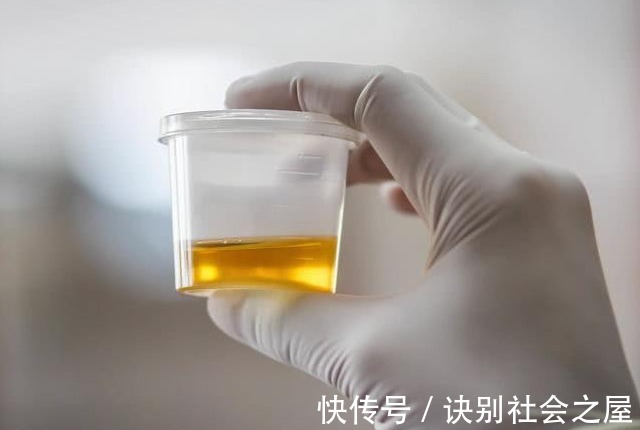 肝气郁结|如何恢复肝脏活力?中医:3个不起眼方法,一周还你“黄金肝”