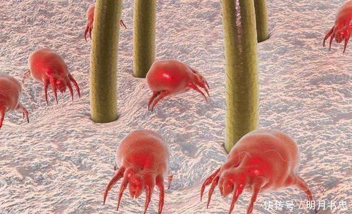 脸上螨虫成窝，68岁老保姆说记住一个土办法，螨虫咔嚓全死光