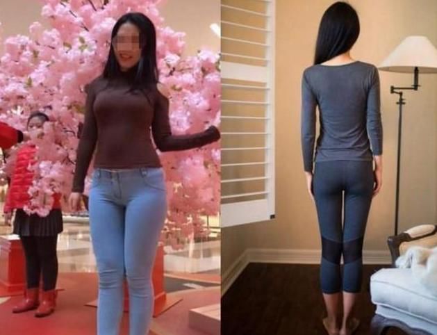 剖腹产|“顺便帮我吸个脂呗”90后宝妈剖腹产时的一个要求,令医生大乐