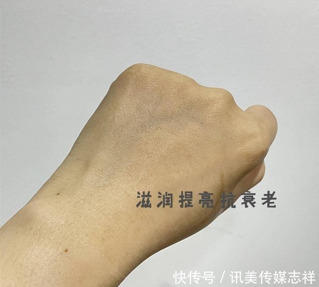 买了裙子,但是鸡皮还没解决!有啥办法缓解鸡皮肤?