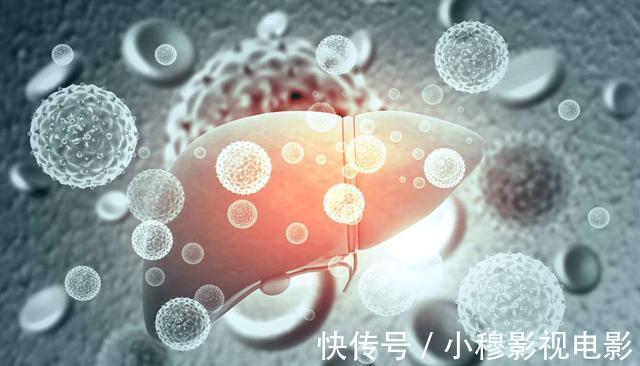 陋习|滴酒不沾，确诊肝癌？医生提醒：3个陋习最好改掉，或比喝酒伤肝