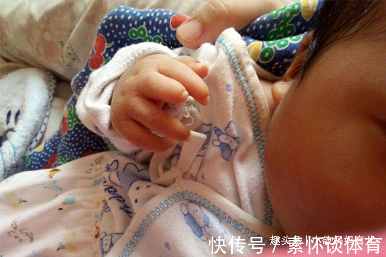 晓玲|宝宝出生长了“凤爪”,宝妈谎称孕期吃了鸡爪,却被医生当场揭穿