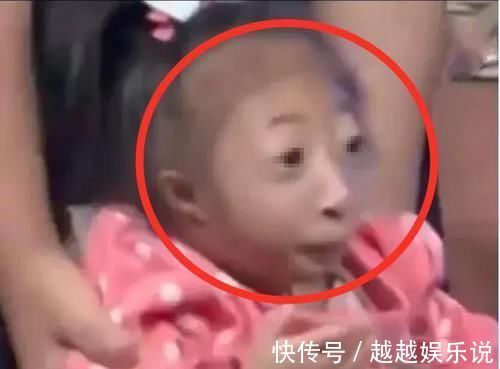 爸爸|小女孩生下来就没有鼻子,爸爸曾想抛弃孩子,妈妈的话让宝爸泪目