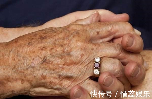 延缓衰老|不想提前长老年斑教你吃5种食物,做好三件事,延缓衰老保健康