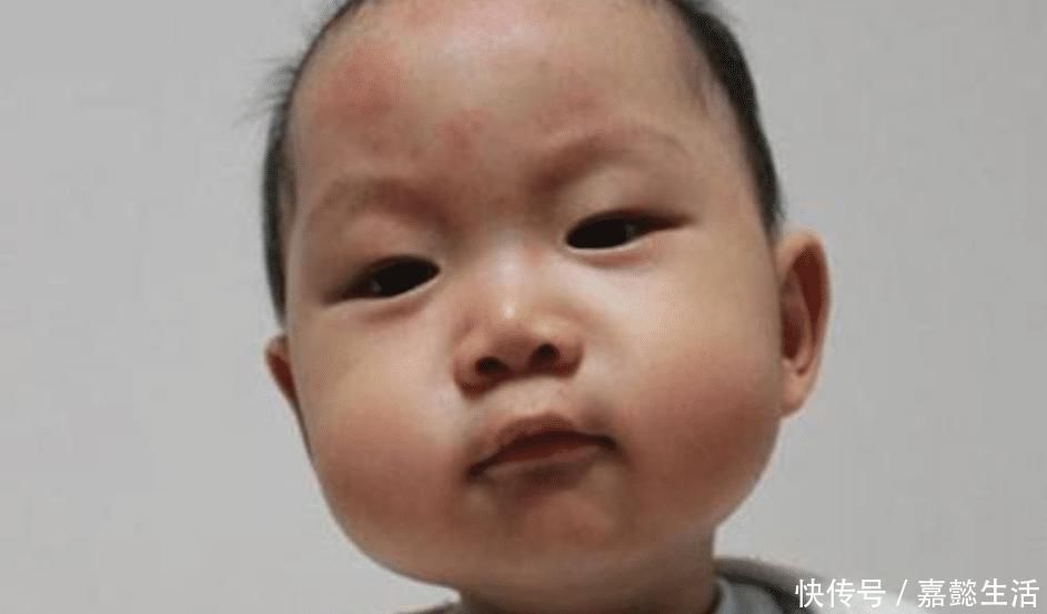 鸡蛋羹|一天一个鸡蛋,3岁宝宝吃出事了检查后发现,惹祸的不止是鸡蛋