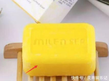 2块钱一块的“硫磺皂”到底有多厉害?解决了很多人的“烦恼”