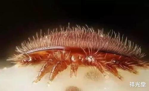 洗头|头没洗两天,指甲缝总能抠出“白泥”,原因简单,很多人容易忽视