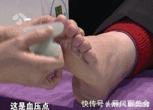 高血压|长期高血压,这个地方就长茧!每天刮5分钟,血压奇迹般降下来!
