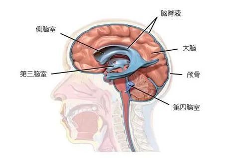 老年病|【健康报】邢岩：别将这类脑积水误认为其他老年病