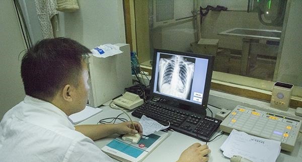 癌细胞|80症，在术后3年有复发风险，癌症复发时，身体有何提示