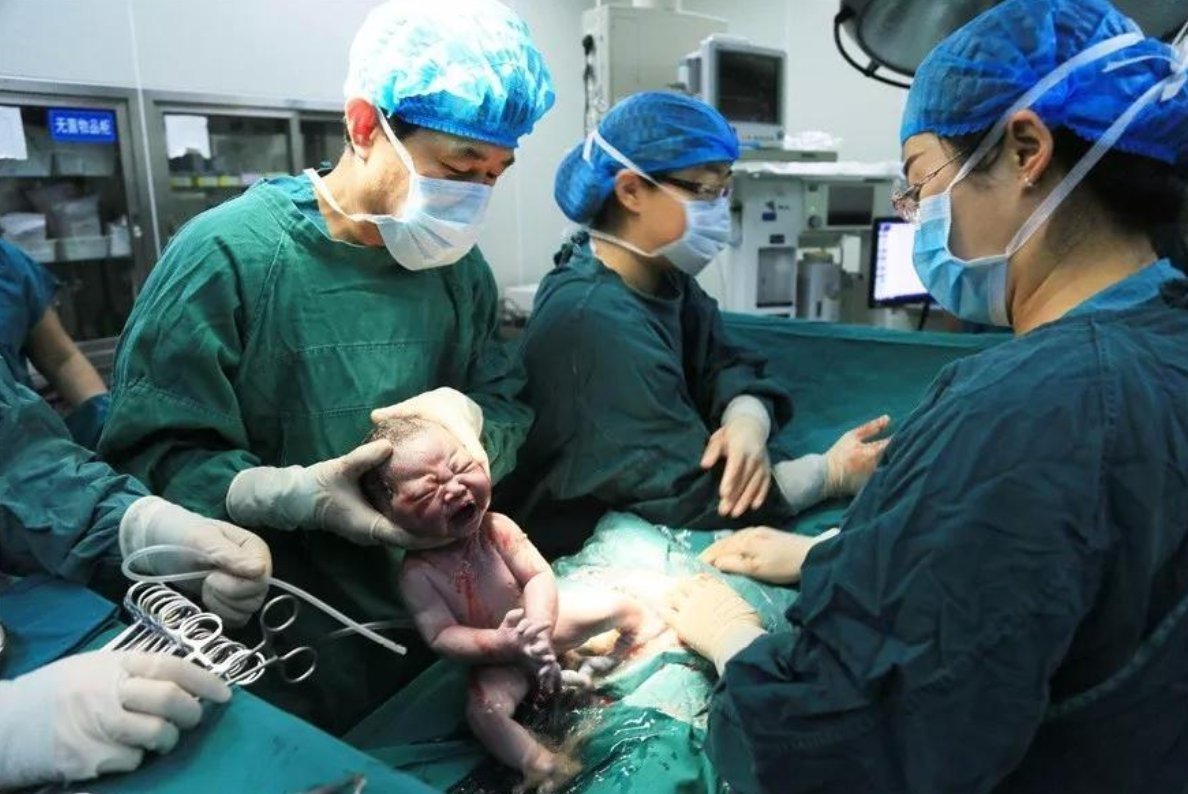 助产士|妇产科男医生成“新宠”,这几点女医生真的比不了,宝妈:技术好