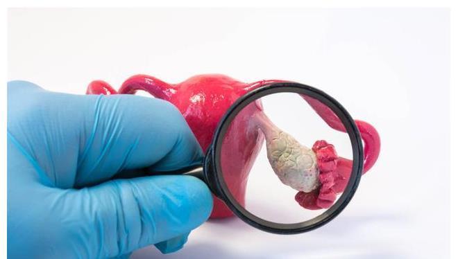 身体衰老|45岁后,卵巢衰老怎么办?及时保养,滋养卵巢防衰老