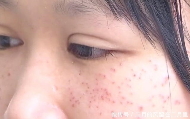 资质|本想花20块理发,却被忽悠贷款1万做祛斑,结果脸变“马蜂窝”