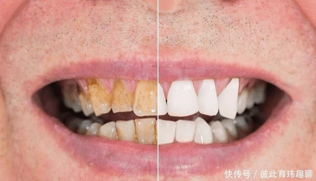 腰部|男性进入更年期的7大“丑态”,你占了几个?一项运动或能拯救你